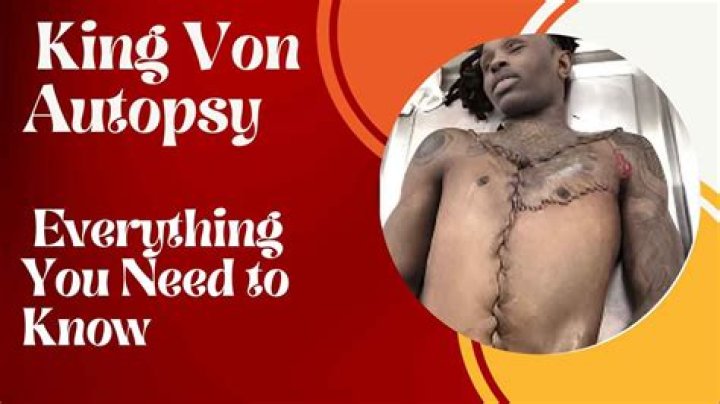 King Von Autopsy Photo: A Deep Dive into the Controversy and Legacy