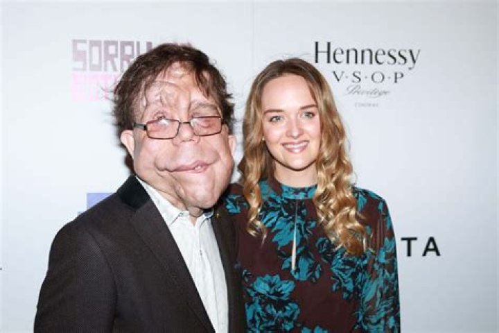 Who is Adam Pearson's Girlfriend? A Deep Dive into His Relationship